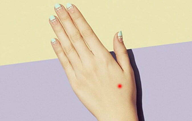 Ví dụ nốt ruồi trên mu bàn tay và cách quan sát