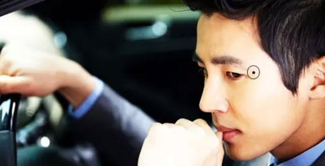 Nốt ruồi trên mặt đàn ông: ví dụ minh họa màu sắc, rìa bờ, độ nổi