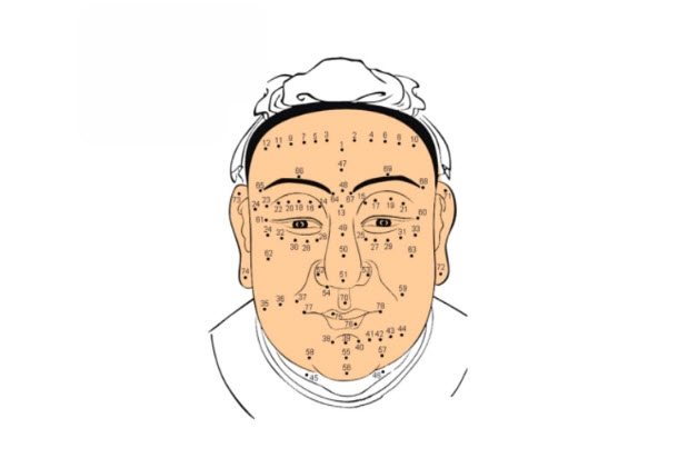 Minh họa nốt ruồi trên cơ thể theo hình thái và sắc độ