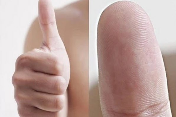 Minh họa kiểu vân tay xoáy ở nam giới