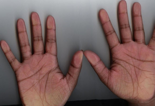 Đường chỉ tay có đúng không? Góc nhìn chiêm nghiệm và giải trí