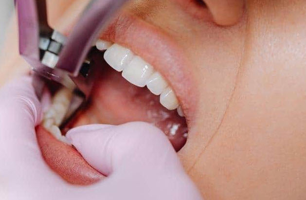 nằm mơ thấy nhổ răng