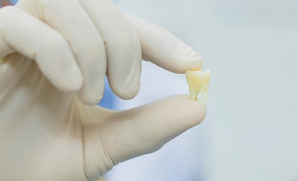 nằm mơ thấy nhổ răng