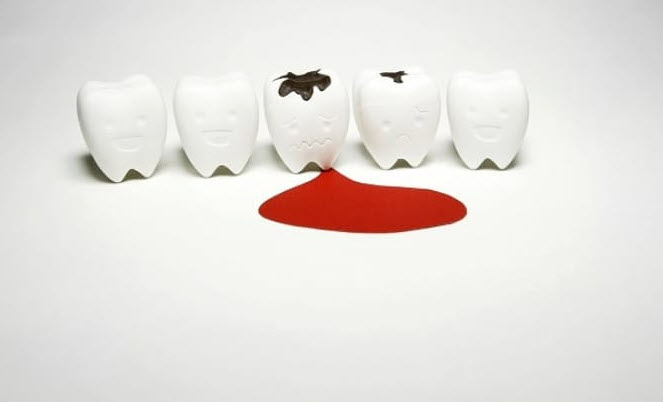 giấc mơ rụng răng chảy máu: cường độ cảm xúc và thông điệp ẩn