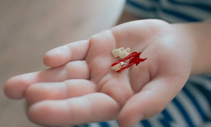 nằm mơ rụng răng chảy máu và các tình huống thường gặp