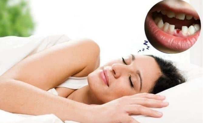 Nằm Mơ Bị Mẻ Răng Báo Hiệu Điều Gì